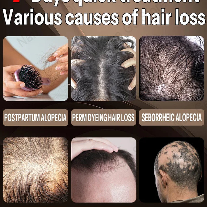 UNISEX OIL FOR HAIR LOSS