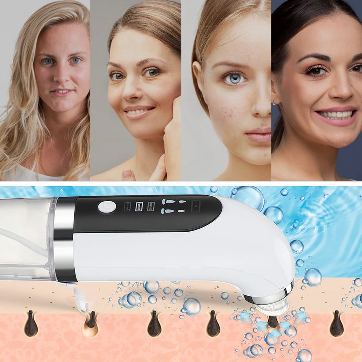 SMALL ELECTRIC REMOVER FOR Pimples, Blackheads, Acnes...