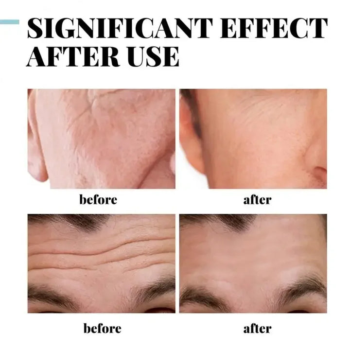 MALE COLLAGEN ANTI-WRINKLE CREAM