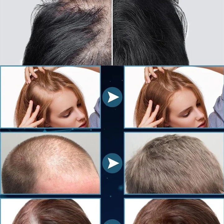 100% NATURAL ANTI HAIR LOSS PRODUCT - UNISEX