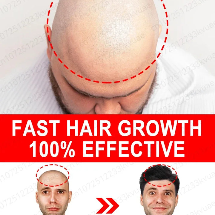 100% NATURAL ANTI HAIR LOSS PRODUCT - UNISEX